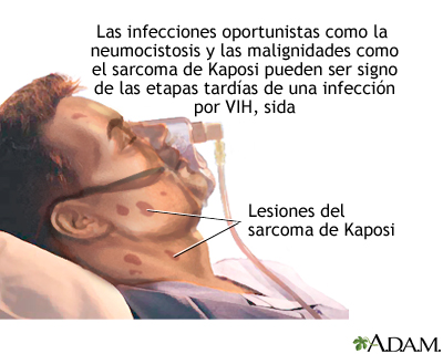 Sida