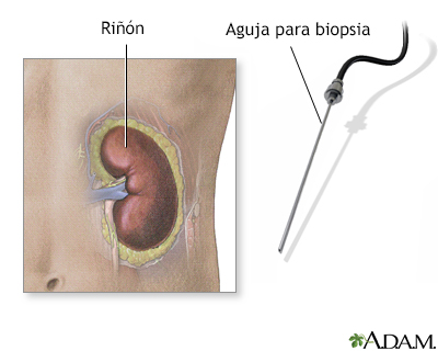 Biopsia renal