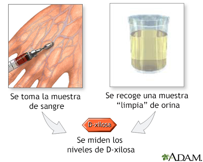 Exmenes de niveles D-xylosa