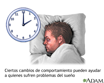 Problemas de insomnio